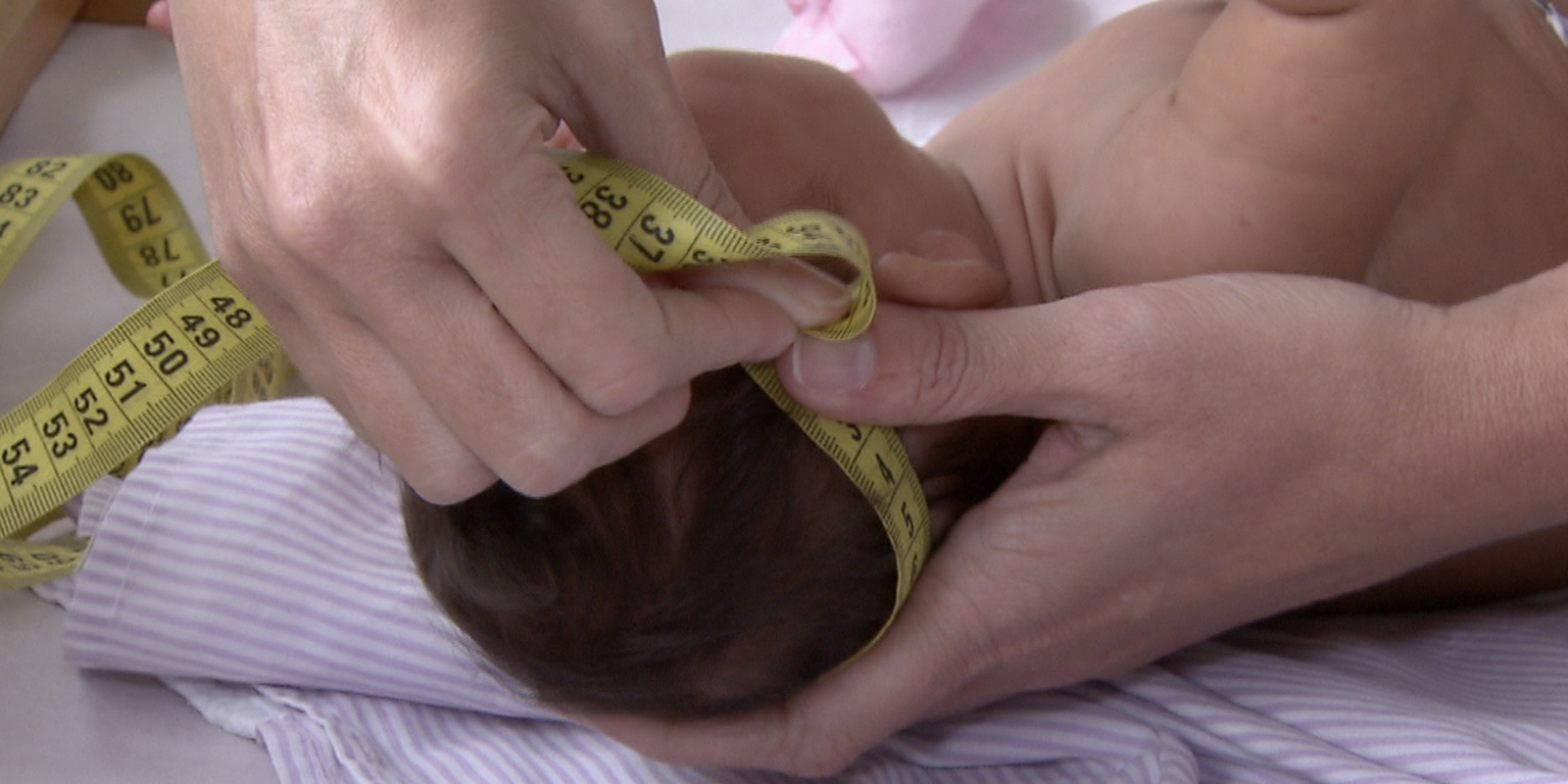 bebe_com_microcefalia.png © TV Brasil